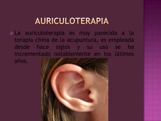 AURICULOTERAPIALa auriculoterapia es muy parecida a la terapia china de la acupuntura, es empleada desde hace siglos y su uso se ha incrementado notablemente en los últimos años.