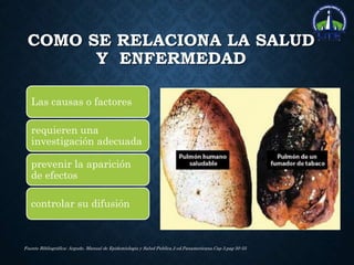 COMO SE RELACIONA LA SALUD
Y ENFERMEDAD
Las causas o factores
requieren una
investigación adecuada
prevenir la aparición
de efectos
controlar su difusión
Fuente Bibliográfica: Argudo. Manual de Epidemiologia y Salud Publica.2 ed.Panamericana.Cap 3.pag 50-55
 