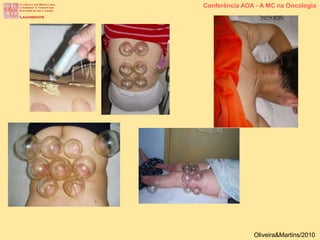 Conferência AOA - A MC na Oncologia
Oliveira&Martins/2010
 