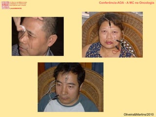 Conferência AOA - A MC na Oncologia
Oliveira&Martins/2010
 