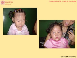 Conferência AOA - A MC na Oncologia
Oliveira&Martins/2010
 