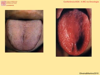 Conferência AOA - A MC na Oncologia
Oliveira&Martins/2010
 