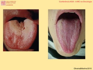 Conferência AOA - A MC na Oncologia
Oliveira&Martins/2010
 