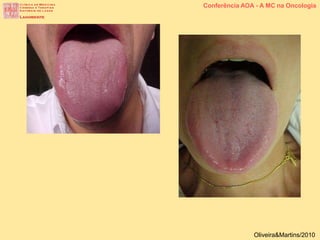 Conferência AOA - A MC na Oncologia
Oliveira&Martins/2010
 