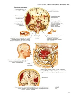 Arlindo Ugulino Netto – MEDICINA DE URG•NCIA – MEDICINA P8 – 2011.1
128
 