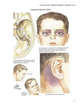 Arlindo Ugulino Netto – MEDICINA DE URG•NCIA – MEDICINA P8 – 2011.1
132
 