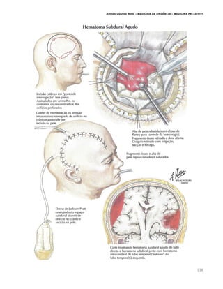 Arlindo Ugulino Netto – MEDICINA DE URG•NCIA – MEDICINA P8 – 2011.1
134
 
