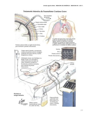 Arlindo Ugulino Netto – MEDICINA DE URG•NCIA – MEDICINA P8 – 2011.1
135
 