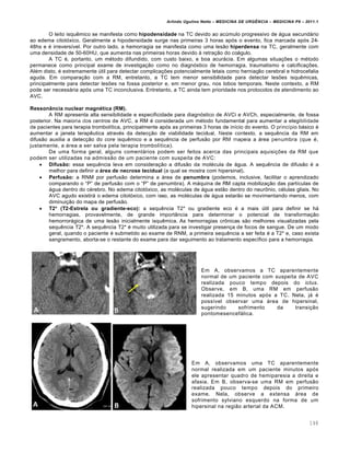 Arlindo Ugulino Netto – MEDICINA DE URG•NCIA – MEDICINA P8 – 2011.1
148
O leito isqu€mico se manifesta como hipodensidade na TC devido ao ac‰mulo progressivo de ƒgua secundƒrio
ao edema citot„xico. Geralmente a hipodensidade surge nas primeiras 3 horas ap„s o evento, fica marcada ap„s 24-
48hs e ‚ irrevers•vel. Por outro lado, a hemorragia se manifesta como uma les…o hiperdensa na TC, geralmente com
uma densidade de 50-60HU, que aumenta nas primeiras horas devido Œ retra†…o do coƒgulo.
A TC ‚, portanto, um m‚todo difundido, com custo baixo, e boa acurƒcia. Em algumas situa†ˆes o m‚todo
permanece como principal exame de investiga†…o como no diagn„stico de hemorragia, traumatismo e calcifica†ˆes.
Al‚m disto, ‚ extremamente ‰til para detectar complica†ˆes potencialmente letais como hernia†…o cerebral e hidrocefalia
aguda. Em compara†…o com a RM, entretanto, a TC tem menor sensibilidade para detectar lesˆes isqu€micas,
principalmente para detectar lesˆes na fossa posterior e, em menor grau, nos lobos temporais. Neste contexto, a RM
pode ser necessƒria ap„s uma TC inconclusiva. Entretanto, a TC ainda tem prioridade nos protocolos de atendimento ao
AVC.
Ressonância nuclear magnética (RM).
A RM apresenta alta sensibilidade e especificidade para diagn„stico de AVCi e AVCh, especialmente, de fossa
posterior. Na maioria dos centros de AVC, a RM ‚ considerada um m‚todo fundamental para aumentar a elegibilidade
de pacientes para terapia trombol•tica, principalmente ap„s as primeiras 3 horas de in•cio do evento. O princ•pio bƒsico ‚
aumentar a janela terap€utica atrav‚s da detec†…o de viabilidade tecidual. Neste contexto, a sequ€ncia da RM em
difus…o auxilia a detec†…o do core isqu€mico e a sequ€ncia de perfus…o por RM mapeia a ƒrea penumbra (que ‚,
justamente, a ƒrea a ser salva pela terapia trombol•tica).
De uma forma geral, alguns comentƒrios podem ser feitos acerca das principais aquisi†ˆes da RM que
podem ser utilizadas na admiss…o de um paciente com suspeita de AVC:
 Difusão: essa sequ€ncia leva em considera†…o a difus…o da mol‚cula de ƒgua. A sequ€ncia de difus…o ‚ a
melhor para definir a área de necrose tecidual (a qual se mostra com hipersinal).
 Perfusão: a RNM por perfus…o determina a ƒrea de penumbra (podemos, inclusive, facilitar o aprendizado
comparando o “P” de perfus…o com o “P” de penumbra). A mƒquina de RM capta mobiliza†…o das part•culas de
ƒgua dentro do c‚rebro. No edema citot„xico, as mol‚culas de ƒgua est…o dentro do neur•nio, c‚lulas gliais. No
AVC agudo existirƒ o edema citot„xico, com isso, as mol‚culas de ƒgua estar…o se movimentando menos, com
diminui†…o do mapa de perfus…o.
 T2* (T2-Estrela ou gradiente-eco): a sequ€ncia T2* ou gradiente eco ‚ a mais ‰til para definir se hƒ
hemorragias, provavelmente, de grande import‡ncia para determinar o potencial de transforma†…o
hemorrorƒgica de uma les…o inicialmente isqu€mica. As hemorragias cr•nicas s…o melhores visualizadas pela
sequ€ncia T2*. A sequ€ncia T2* ‚ muito utilizada para se investigar presen†a de focos de sangue. De um modo
geral, quando o paciente ‚ submetido ao exame de RNM, a primeira sequ€ncia a ser feita ‚ a T2* e, caso exista
sangramento, aborta-se o restante do exame para dar seguimento ao tratamento espec•fico para a hemorragia.
Em A, observamos a TC aparentemente
normal de um paciente com suspeita de AVC
realizada pouco tempo depois do ictus.
Observe, em B, uma RM em perfus…o
realizada 15 minutos ap„s a TC. Nela, jƒ ‚
poss•vel observar uma ƒrea de hipersinal,
sugerindo sofrimento da transi†…o
pontomesencefƒlica.
Em A, observamos uma TC aparentemente
normal realizada em um paciente minutos ap„s
ele apresentar quadro de hemiparesia a direita e
afasia. Em B, observa-se uma RM em perfus…o
realizada pouco tempo depois do primeiro
exame. Nela, observe a extensa ƒrea de
sofrimento sylviano esquerdo na forma de um
hipersinal na regi…o arterial da ACM.
 
