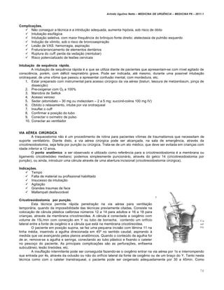 Arlindo Ugulino Netto – MEDICINA DE URG•NCIA – MEDICINA P8 – 2011.1
74
Complicações.
 N…o conseguir a t‚cnica e a intridu†…o adequada, aumenta hip„xia, sob risco de „bito
 Intuba†…o esofƒgica
 Intuba†…o seletiva, com maior frequ€ncia do br•nquio fonte direito; atelectasia de pulm…o esquerdo
 Indu†…o de v•mito, sob o risco de broncoaspira†…o
 Les…o de VAS: hemorragia, aspira†…o
 Fratura/arrancamento de elementos dentƒrios
 Ruptura do cuff: perda da veda†…o (reintubar)
 Risco potencializado de lesˆes cervicais
Intubação de sequência rápida.
A intuba†…o de sequ€ncia rƒpida ‚ a que se utiliza diante de pacientes que apresentam-se com n•vel agitado de
consci€ncia, por‚m, com d‚ficit respirat„rio grave. Pode ser indicada, at‚ mesmo, durante uma poss•vel intuba†…o
orotraqueal, de uma v•tima que passou a apresentar confus…o mental, com mordedura, etc.
1. Estar preparado com instrumental para acesso cir‰rgico da via a‚rea (bisturi, tesoura de metzenbaum, pin†a de
dissec†…o)
2. Pre-oxigenar com O2 a 100%
3. Manobra de Sellick
4. Acesso venoso
5. Sedar (etomidato – 30 mg ou midazolam – 2 a 5 mg; succinil-colina 100 mg IV)
6. Obtido o relaxamento, intube por via orotraqueal
7. Insuflar o cuff
8. Confirmar a posi†…o do tubo
9. Conectar o ox•metro de pulso
10. Conectar ao ventilador
VIA AÉREA CIRÚRGICA
A traqueostomia n…o ‚ um procedimento de rotina para pacientes v•timas de traumatismos que necessitam de
suporte ventilat„rio. Diante disto, a via a‚rea cir‰rgica pode ser alcan†ada, na sala de emerg€ncia, atrav‚s da
cricotireoidostomia, seja feita por pun†…o ou cir‰rgica. Trata-se de um ato m‚dico, que deve ser evitada em crian†as com
idade inferior a 12 anos.
O ponto anatômico a ser observado e utilizado como refer€ncia para a cricotireoidostomia ‚ a membrana ou
ligamento cricotire„ideo mediano; podemos simplesmente puncionƒ-lo, atrav‚s do gelco 14 (cricotireoidostomia por
pun†…o), ou ainda, introduzir uma c‡nula atrav‚s de uma abertura incisional (cricotireoidostomia cir‰rgica).
Indicações.
 Tempo
 Falta de material ou profissional habilitado
 Insucesso da intuba†…o
 Agita†…o
 Grandes traumas de face
 Mallampati desfavorƒvel
Cricotireoidostomia por punção.
Esta t‚cnica permite rƒpida penetra†…o na via a‚rea para ventila†…o
temporƒria, quando da impossibilidade das t‚cnicas previamente citadas. Consiste na
coloca†…o de c‡nula plƒstica calibrosa n‰meros 12 a 14 para adultos e 16 a 18 para
crian†as, atrav‚s da membrana cricotireo•dea. A c‡nula ‚ conectada a oxig€nio com
volume de 15L/min com conec†…o em Y ou tubo de borracha, contendo um orif•cio
lateral entre a fonte de oxig€nio e a c‡nula que estƒ na membrana cricotireo•dea.
O paciente em posi†…o supina, se faz uma pequena incis…o com l‡mina 11 na
linha m‚dia, inserindo a agulha direcionada em 45› no sentido caudal, aspirando Œ
medida que vai avan†ando pelos planos anat•micos. Quando o conte‰do da agulha for
de ar, remove-se a agulha e seringa, conectando ao tubo plƒstico e fixando o cateter
no pesco†o do paciente. As principais complica†ˆes s…o as perfura†ˆes, enfisema
subcut‡neo, les…o tire„idea, etc.
A insufla†…o intermitente pode ser conseguida fazendo-se o oxig€nio entrar na via a‚rea por 1s e interrompendo
sua entrada por 4s, atrav‚s da oclus…o ou n…o do orif•cio lateral da fonte de oxig€nio ou de um bra†o do Y. Tanto nesta
t‚cnica como com o cateter transtraqueal, o paciente pode ser oxigenado adequadamente por 30 a 45min. Como
 