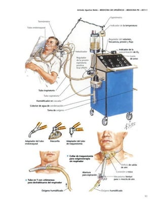 Arlindo Ugulino Netto – MEDICINA DE URG•NCIA – MEDICINA P8 – 2011.1
80
 