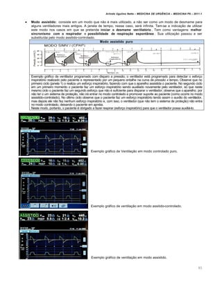 Arlindo Ugulino Netto – MEDICINA DE URG•NCIA – MEDICINA P8 – 2011.1
85
 Modo assistido: consiste em um modo que não é mais utilizado, a não ser como um modo de desmame para
alguns ventiladores mais antigos. A janela de tempo, nesse caso, será infinita. Tem-se a indicação de utilizar
este modo nos casos em que se pretende iniciar o desmame ventilatório . Tem como vantagens: melhor
sincronismo com o respirador e possibilidade de respiração espontânea . Sua utilização passou a ser
substituída pelo modo assitido-controlado.
Modo assistido puro
Exemplo gráfico de ventilador programado com disparo a pressão, o ventilador está programado para detectar o esforço
inspiratório realizado pelo paciente e representado por um pequeno entalhe na curva de pressão x tempo. Observe que no
primeiro ciclo (janela 1) o realiza um esforço inspiratório, fazendo com que o aparelho assistida o paciente. No segundo ciclo
em um primeiro momento o paciente faz um esforço inspiratório sendo auxiliado novamente pelo ventilador, só que neste
mesmo ciclo o paciente faz um segundo esforço que não é suficiente para disparar o ventilador; observe que o aparelho, por
não ter o um sistema de proteção, não irá entrar no modo controlado e promover suporte ao paciente (como ocorre no modo
assistido-controlado). No último ciclo observe que o paciente faz um esforço inspiratório tendo assim o auxílio do ventilador,
mas depois ele não fez nenhum esforço inspiratório e, com isso, o ventilador (que não tem o sistema de proteção) não entra
no modo controlado, deixando o paciente em apnéia.
Neste modo, portanto, o paciente é obrigado a fazer respirar (esforço inspiratório) para que o ventilador possa auxiliá-lo.
Exemplo gráfico de Ventilação em modo controlado puro.
Exemplo gráfico de ventilação em modo assitido-controlado.
Exemplo gráfico de ventilação em modo assistido.
 