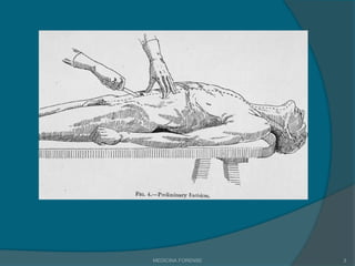Cronotanatodiagnósticos