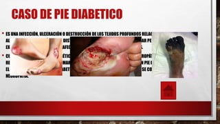 CASO DE PIE DIABETICO
• ES UNA INFECCIÓN, ULCERACIÓN O DESTRUCCIÓN DE LOS TEJIDOS PROFUNDOS RELACIONADOS CON
ALTERACIONES NEUROLÓGICAS Y DISTINTOS GRADOS DE ENFERMEDAD VASCULAR PERIFÉRICA EN LAS
EXTREMIDADES INFERIORES QUE AFECTA A PACIENTES CON DIABETES MELLITUS.
• CUANDO SE DICE QUE EL PIE DIABÉTICO TIENE UNA "BASE ETIOPATOGÉNICA NEUROPÁTICA" SE HACE
REFERENCIA A QUE LA CAUSA PRIMARIA QUE HACE QUE SE LLEGUE A PADECER UN PIE DIABÉTICO ESTÁ EN
EL DAÑO PROGRESIVO QUE LA DIABETES PRODUCE SOBRE LOS NERVIOS, LO QUE SE CONOCE COMO
NEUROPATÍA.
 