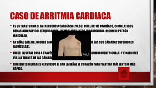 CASO DE ARRITMIA CARDIACA
• ES UN TRASTORNO DE LA FRECUENCIA CARDÍACA (PULSO) O DEL RITMO CARDÍACO, COMO LATIDOS
DEMASIADO RÁPIDOS (TAQUICARDIA), DEMASIADO LENTOS (BRADICARDIA)O CON UN PATRÓN
IRREGULAR.
• LA SEÑAL SALE DEL NÓDULO SINOAURICULAR Y VIAJA A TRAVÉS DE LAS DOS CÁMARAS SUPERIORES
(AURÍCULAS).
• LUEGO, LA SEÑAL PASA A TRAVÉS DE OTRO NÓDULO (EL NÓDULOAURICULOVENTRICULAR) Y FINALMENTE
VIAJA A TRAVÉS DE LAS CÁMARAS INFERIORES (VENTRÍCULOS).
• DIFERENTES MENSAJES NERVIOSOS LE DAN LA SEÑAL AL CORAZÓN PARA PALPITAR MÁS LENTO O MÁS
RÁPIDO.
 