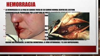 HEMORRAGIA
• LA HEMORRAGIA ES LA FUGA DE SANGRE FUERA DE SU CAMINO NORMAL DENTRO DEL SISTEMA
CARDIOVASCULAR PROVOCADA POR LA RUPTURA DE VASOS SANGUÍNEOS COMOVENAS, ARTERIAS Y
CAPILARES. ES UNA SITUACIÓN QUE PROVOCA UNA PÉRDIDA PELIGROSA DESANGRE Y PUEDE SER INTERNA O
EXTERNA
• HEMORRAGIA INTERNA: ES LA RUPTURA DE ALGÚN VASO SANGUÍNEO EN ELINTERIOR DEL CUERPO.
• HEMORRAGIA EXTERNA: ES LA HEMORRAGIA PRODUCIDA POR RUPTURA DE VASOS SANGUÍNEOS A TRAVÉS DE
LA PIEL, ESTE TIPO DE HEMORRAGIAS ES PRODUCIDA FRECUENTEMENTE POR HERIDAS ABIERTAS.
• HEMORRAGIA EXTERIORIZADA: A TRAVÉS DE ORIFICIOS NATURALES DEL CUERPO, COMO EL RECTO
(RECTORRAGIA), LA BOCA VOMITANDO (HEMATEMESIS) O TOSIENDO (HEMOPTISIS), LA NARIZ (EPISTAXIS), LA
VAGINA (METRORRAGIA), LA URETRA (HEMATURIA), EL OÍDO (OTORRAGIA), Y EL OJO (HIPOSFAGMA).
 