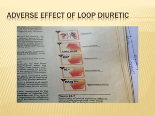 ADVERSE EFFECT OF LOOP DIURETIC
 