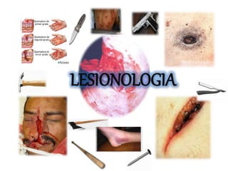 LESIONOLOGIA
 
