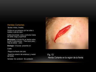 Coleta Raton Medicina legal | PPTX