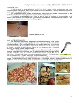 Arlindo Ugulino Netto; Luiz Gustavo Barros; Yuri Leite Eloy – MEDICINA LEGAL – MEDICINA P8 – 2011.1
22
Ferimento de Saída.
A lesão de saída as feridas produzidas por PAF tem forma irregular, bordas reviradas para fora, maior
sangramento e não apresenta orla de escoriação nem halo de enxurgo, nem mesmo a presença dos elementos químicos
resultantes da decomposição da pólvora.
Sua forma é irregular e tem diâmetro geralmente maior que o do orifício de entrada. A deformidade se dá pela
resistência encontrada nos diversos planos e nunca conserva seu eixo longitudinal.
As bordas são reviradas para fora, em virtude de ação do projétil se processar em sentido contrário ao de
entrada, ou seja, de dentro para fora. São mais sangrantes pelo maior diâmetro, pela irregularidade de sua forma e pela
eversão das bordas, permitindo, assim um maior fluxo sanguíneo.
Ferimento de saída por PAF.
AÇÃO CORTO-CONTUNDENTE
São instrumentos que possuem gume rombo, de corte embotado e que agindo sobre o
organismo, rompe a integridade da pele, produzindo feridas irregulares, retraídas e com bordas
muito traumatizadas. É mais frequente no homicídio e no acidente, sendo raro no suicídio. Os
principais instrumentos são machado, foice, facão, enxada, moto-serra, rodas de trem etc. Agem
por pressão e percussão ou deslizamento. A lesão se faz mais pelo próprio peso e intensidade
de manejo, do que pelo gume de que são dotados.
A forma das feridas varia conforme a região comprometida, a intensidade de manejo, a
inclinação, o peso e o fio do instrumento. São em regra mutilantes, abertas, grandes, fraturas,
contusões nas bordas, perda de substância e cicatrizam por segunda intenção. Em geral, o
prognóstico é grave quanto à vida ou em hipótese mais benigna, quanto à importância de um
dano, incapacitando para o trabalho, deformando, inutilizando membro etc.
Na perícia, o aspecto da escoriação é suficiente para indicar se o ferimento foi feito num indivíduo vivo ou num
cadáver. Permite também conclusões quanto ao objeto usado e a natureza do atentado. As escoriações produzidas no
vivo formam crosta. No cadáver são lisas e muito semelhantes ao aspecto de couro ou de pergaminho
 