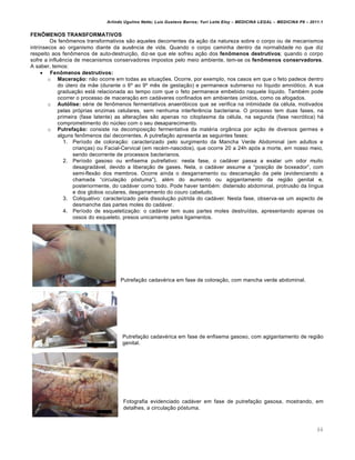 Arlindo Ugulino Netto; Luiz Gustavo Barros; Yuri Leite Eloy – MEDICINA LEGAL – MEDICINA P8 – 2011.1
66
FENÔMENOS TRANSFORMATIVOS
Os fen•menos transformativos s„o aqueles decorrentes da a‚„o da natureza sobre o corpo ou de mecanismos
intr•nsecos ao organismo diante da aus…ncia de vida. Quando o corpo caminha dentro da normalidade no que diz
respeito aos fen•menos de auto-destrui‚„o, diz-se que ele sofreu a‚„o dos fenômenos destrutivos; quando o corpo
sofre a influ…ncia de mecanismos conservadores impostos pelo meio ambiente, tem-se os fenômenos conservadores.
A saber, temos:
 Fenômenos destrutivos:
o Maceração: n„o ocorre em todas as situa‚‡es. Ocorre, por exemplo, nos casos em que o feto padece dentro
do ‹tero da m„e (durante o 6• ao 9• m…s de gesta‚„o) e permanece submerso no l•quido amniƒtico. A sua
gradua‚„o estˆ relacionada ao tempo com que o feto permanece embebido naquele l•quido. Tamb€m pode
ocorrer o processo de macera‚„o em cadˆveres confinados em ambientes ‹midos, como os afogados.
o Autólise: s€rie de fen•menos fermentativos anaerƒbicos que se verifica na intimidade da c€lula, motivados
pelas prƒprias enzimas celulares, sem nenhuma interfer…ncia bacteriana. O processo tem duas fases, na
primeira (fase latente) as altera‚‡es s„o apenas no citoplasma da c€lula, na segunda (fase necrƒtica) hˆ
comprometimento do n‹cleo com o seu desaparecimento.
o Putrefação: consiste na decomposi‚„o fermentativa da mat€ria orgŽnica por a‚„o de diversos germes e
alguns fen•menos da• decorrentes. A putrefa‚„o apresenta as seguintes fases:
1. Per•odo de colora‚„o: caracterizado pelo surgimento da Mancha Verde Abdominal (em adultos e
crian‚as) ou Facial-Cervical (em rec€m-nascidos), que ocorre 20 a 24h apƒs a morte, em nosso meio,
sendo decorrente de processos bacterianos.
2. Per•odo gasoso ou enfisema putrefativo: nesta fase, o cadˆver passa a exalar um odor muito
desagradˆvel, devido a libera‚„o de gases. Nela, o cadˆver assume a “posi‚„o de boxeador”, com
semi-flex„o dos membros. Ocorre ainda o desgarramento ou descama‚„o da pele (evidenciando a
chamada “circula‚„o pƒstuma”), al€m do aumento ou agigantamento da regi„o genital e,
posteriormente, do cadˆver como todo. Pode haver tamb€m: distens„o abdominal, protrus„o da l•ngua
e dos globos oculares, desgarramento do couro cabeludo.
3. Coliquativo: caracterizado pela dissolu‚„o p‹trida do cadˆver. Nesta fase, observa-se um aspecto de
desmanche das partes moles do cadˆver.
4. Per•odo de esqueletiza‚„o: o cadˆver tem suas partes moles destru•das, apresentando apenas os
ossos do esqueleto, presos unicamente pelos ligamentos.
Putrefa‚„o cadav€rica em fase de colora‚„o, com mancha verde abdominal.
Putrefa‚„o cadav€rica em fase de enfisema gasoso, com agigantamento de regi„o
genital.
Fotografia evidenciado cadˆver em fase de putrefa‚„o gasosa, mostrando, em
detalhes, a circula‚„o pƒstuma.
 