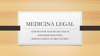 MEDICINA LEGAL
LESIONES POR AGENTES MECÁNICOS
(EQUIMOSIS-HEMATOMA)
JESSENIA KARINA ALVAREZ ALVAREZ
 