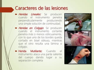 Caracteres de las lesiones
 Heridas Lineales: Se producen
cuando el instrumento penetra
perpendicularmente produciendo
una simple solución de continuidad.
 Heridas en Colgajo: Se producen
cuando el instrumento cortante
penetra más o menos oblicuamente,
con lo que uno de los bordes queda
cortado en bisel obtuso, mientras
que el otro resulta una lámina o
colgajo.
 Herida Mutilante: Cuando el
instrumento ataca una parte saliente
del cuerpo dando lugar a su
separación completa
 