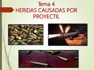 Tema 4
HERIDAS CAUSADAS POR
PROYECTIL
 