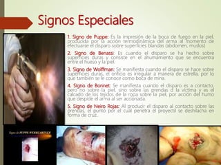 Signos Especiales
1. Signo de Puppe: Es la impresión de la boca de fuego en la piel,
producida por la acción termodinámica del arma al momento de
efectuarse el disparo sobre superficies blandas (abdomen, muslos)
2. Signo de Benassi: Es cuando el disparo se ha hecho sobre
superficies duras y consiste en el ahumamiento que se encuentra
entre el hueso y la piel.
3. Signo de Wolffman: Se manifiesta cuando el disparo se hace sobre
superficies duras, el orificio es irregular a manera de estrella, por lo
que también se le conoce como boca de mina.
4. Signo de Bonnet: Se manifiesta cuando el disparo es a contacto,
pero no sobre la piel, sino sobre las prendas d la víctima y es el
calcado de los tejidos de la ropa sobre la piel, por acción del humo
que despide el arma al ser accionada.
5. Signo de Neiro Rojas: Al producir el disparo al contacto sobre las
prendas, el punto por el cual penetra el proyectil se deshilacha en
forma de cruz.
 