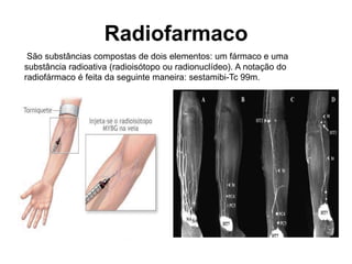 Radiofarmaco
 São substâncias compostas de dois elementos: um fármaco e uma
substância radioativa (radioisótopo ou radionuclídeo). A notação do
radiofármaco é feita da seguinte maneira: sestamibi-Tc 99m.
 