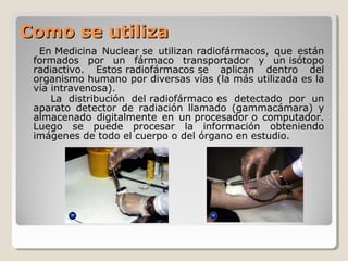 Como se utilizaComo se utiliza
En Medicina Nuclear se utilizan radiofármacos, que están
formados por un fármaco transportador y un isótopo
radiactivo. Estos radiofármacos se aplican dentro del
organismo humano por diversas vías (la más utilizada es la
vía intravenosa).
La distribución del radiofármaco es detectado por un
aparato detector de radiación llamado (gammacámara) y
almacenado digitalmente en un procesador o computador.
Luego se puede procesar la información obteniendo
imágenes de todo el cuerpo o del órgano en estudio.
 