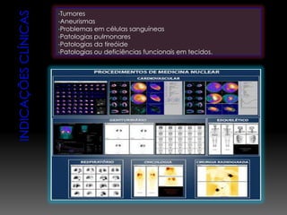 •Tumores
•Aneurismas
•Problemas em células sanguíneas
•Patologias pulmonares
•Patologias da tireóide
•Patologias ou deficiências funcionais em tecidos.
 