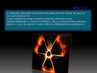 A radiação absorvida na Medicina Nuclear é muito menor do que na
Convencional ou TC.
O que realmente pode ocasionar reações adversas como
hipersensibilidade e choque anafilático, são os componentes químicos .
Sendo o custo do exame o maior vilão na utilidade do procedimento.
 