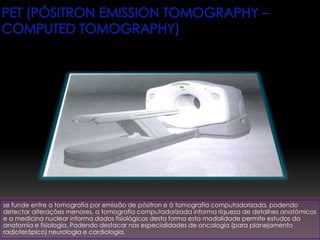 se funde entre a tomografia por emissão de pósitron e à tomografia computadorizada, podendo
detectar alterações menores, a tomografia computadorizada informa riqueza de detalhes anatômicos
e a medicina nuclear informa dados fisiológicos desta forma esta modalidade permite estudos da
anatomia e fisiologia. Podendo destacar nas especialidades de oncologia (para planejamento
radioterápico) neurologia e cardiologia.
 