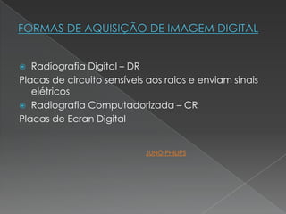  Radiografia Digital – DR
Placas de circuito sensíveis aos raios e enviam sinais
elétricos
 Radiografia Computadorizada – CR
Placas de Ecran Digital
JUNO PHILIPS
 