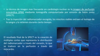 • La técnica de imagen mas frecuente en cardiología nuclear es la imagen de perfusión
miocárdica (IPM) mediante tomografía...