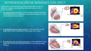 REPRESENTACIÓN DE IMÁGENES CON SPECT
A partir de la reconstrucción tridimensional del corazón se
obtienen imágenes tomográ...