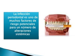 La infección
periodontal es uno de
muchos factores de
riesgo potenciales
para un número de
alteraciones
sistémicas
 