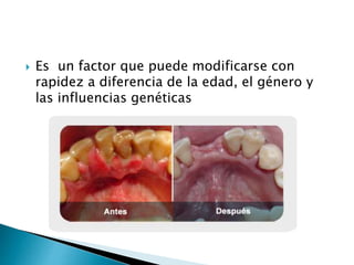  Es un factor que puede modificarse con
rapidez a diferencia de la edad, el género y
las influencias genéticas
 