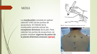 MOXA
La moxibustión consiste en aplicar
calor(40°c/48°c)a los puntos de
acupuntura. El método de la
moxibustión permite activar los
receptores térmicos de la piel, Para
calentar los puntos de acupuntura, se
pueden emplear cigarros de polvo de
la planta Artemisia sinensis (ajenjo)
 