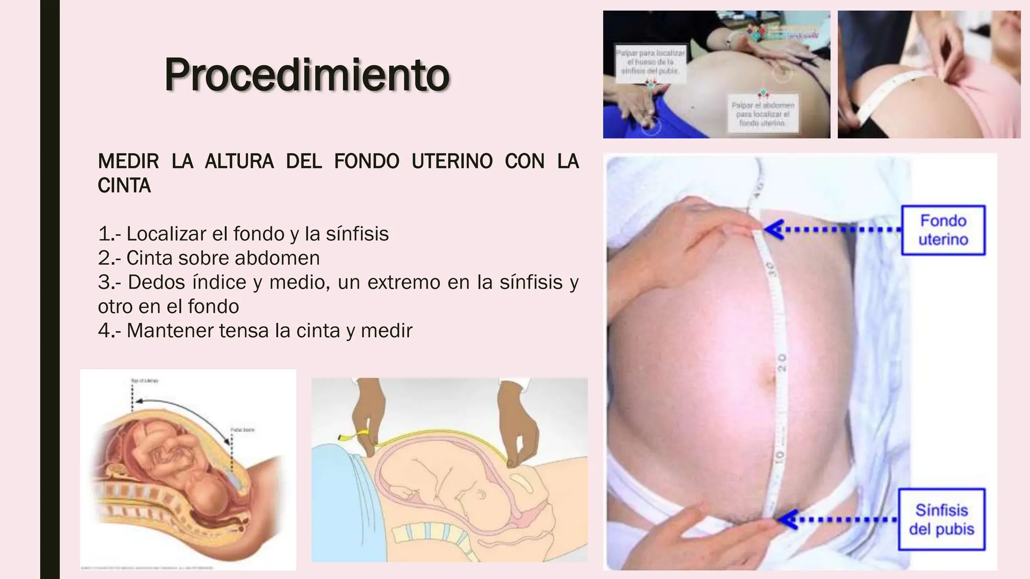 Medici n De Altura De Fondo Uterino pptx
