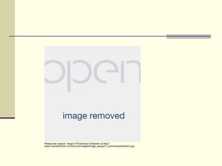 Please see original image of Pulmonary Embolism at http://
www.riversideonline.com/source/images/image_popup/r7_pulmonaryembolism.jpg

 