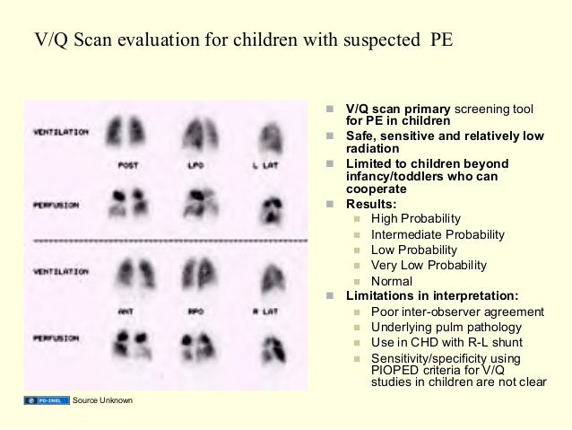 Gemc Acute Pulmonary Emergencies Pulmonary Embolism Pulmonary Ed