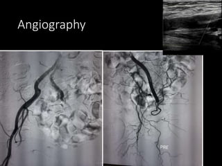 Vascular & Interventional Radiology | PPTX