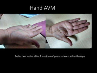 Vascular & Interventional Radiology | PPTX