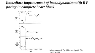 High Rv Pacing Review of conduction system pacing | PPTX
