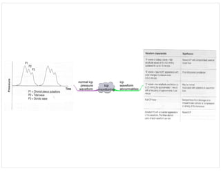 icp
monitoring
icp
waveform
abnormalities
normal icp
pressure
waveform
 