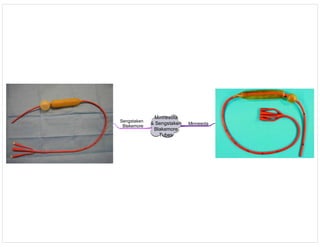 Minnesota
& Sengstaken
Blakemore
Tubes
Minnesota
Sengstaken
Blakemore
 