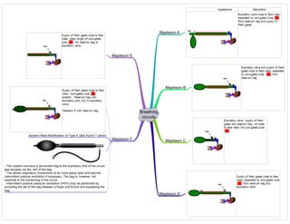 Breathing
circuits
Mapleson A
Mapleson B
Mapleson C
Mapleson D
Mapleson E
Mapleson F
Jackson Rees Modification of Type E (aka Ayre's T piece)
- This system connects a two-ended bag to the expiratory limb of the circuit;
gas escapes via the `tail' of the bag.
- This allows respiratory movements to be more easily seen and permits
intermittent positive ventilation if necessary. The bag is, however, not
essential to the functioning of the circuit.
- Intermittent positive pressure ventilation (IPPV) may be performed by
occluding the tail of the bag between a finger and thumb and squeezing the
bag.
 