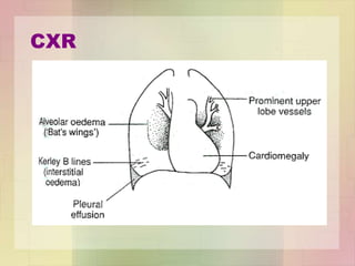 CXR
 